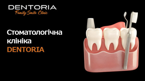 Стоматологічна клініка у Одесі. Dentoria