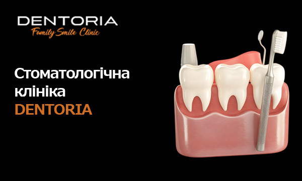 Стоматологічна клініка у Одесі. Dentoria